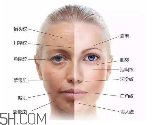 怎么預防皺紋的產生？導致皺紋的產生的原因有哪些？