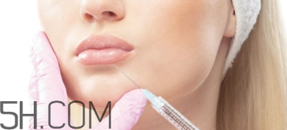 嬰兒肥能打瘦臉針嗎？瘦臉針打幾次可以定型？