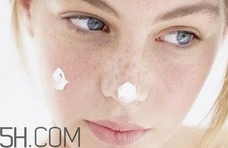 常見的色斑有哪些？常見的色斑有哪些種類？