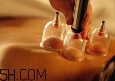 拔罐可以治療鼻炎嗎？鼻炎拔罐拔哪里？