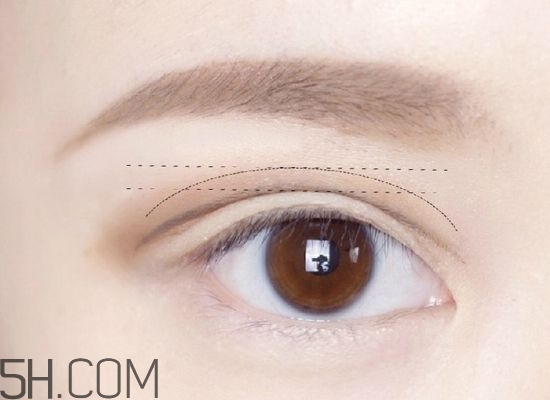 割完雙眼皮不能吃什么？割完雙眼皮如何進行飲食調(diào)理？