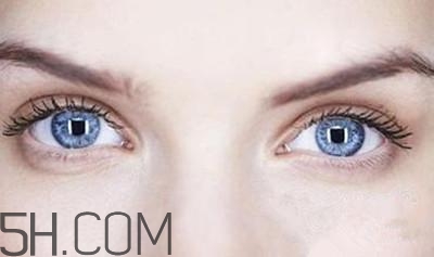 割完雙眼皮不能吃什么？割完雙眼皮如何進行飲食調(diào)理？