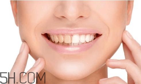 羨慕別人的大白牙？為什么你的牙齒這么黃？