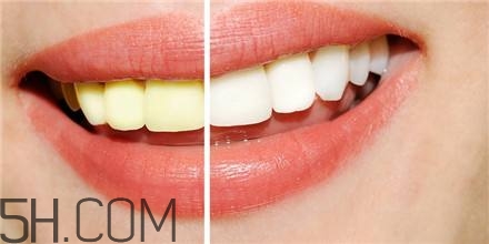 羨慕別人的大白牙？為什么你的牙齒這么黃？