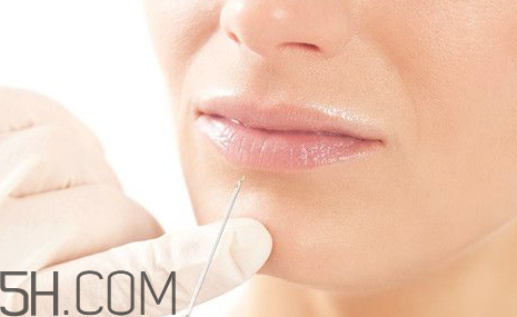 線雕后多久可以打水光針？如何減小水光針的風(fēng)險？