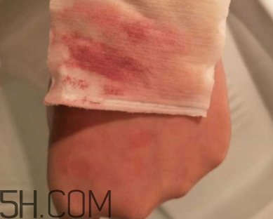 unny卸妝水和蓓昂斯哪個(gè)好？unny卸妝水和蓓昂斯對(duì)比