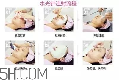 打水光針多久打一次？水光針的誤區(qū)