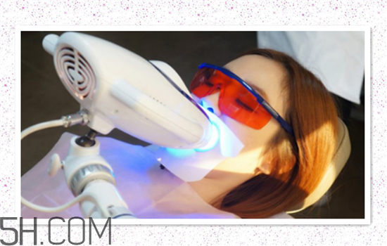 超聲波洗牙可以美白牙齒嗎？超聲波洗牙多少錢一次？