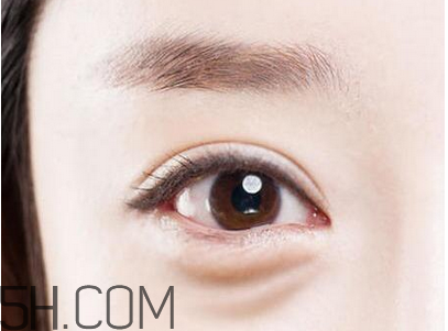 超聲法去眼袋效果好不好？超聲刀可以去除眼袋嗎？