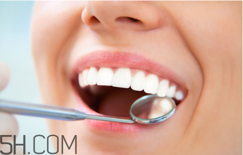 哪些情況不宜洗牙？洗牙后要注意什么？