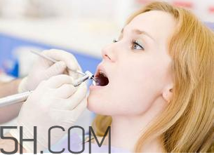 烤瓷牙洗牙要注意什么？洗牙的危害