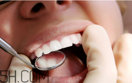 洗牙后牙縫變大是怎么回事？怎么保持牙齒潔白？