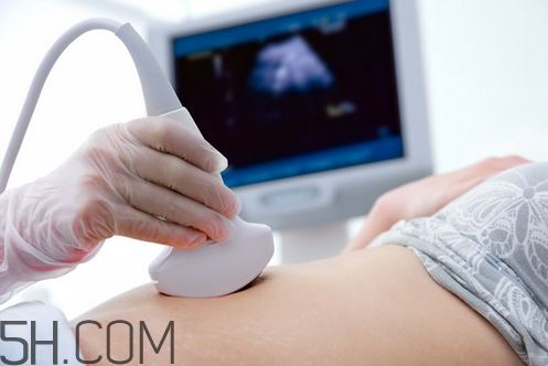 b超是檢查什么的？做b超時肚子上涂的是什么？
