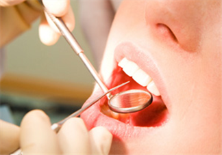 哪些情況不宜洗牙？洗牙后要注意什么？