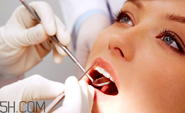 哪些情況不宜洗牙？洗牙后要注意什么？