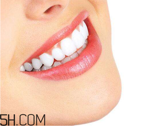 烤瓷牙為什么會(huì)有縫隙？烤瓷牙的注意事項(xiàng)有哪些？