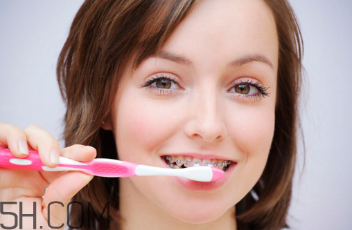 戴牙套可以懷孕嗎？牙齒矯正的后遺癥