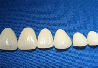 牙齒做貼面多少錢一顆？烤瓷牙可以取下來嗎？