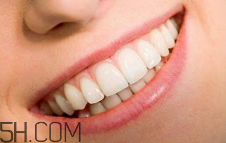 牙齒做貼面多少錢一顆？烤瓷牙可以取下來嗎？