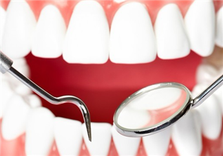 戴牙套可以懷孕嗎？牙齒矯正的后遺癥