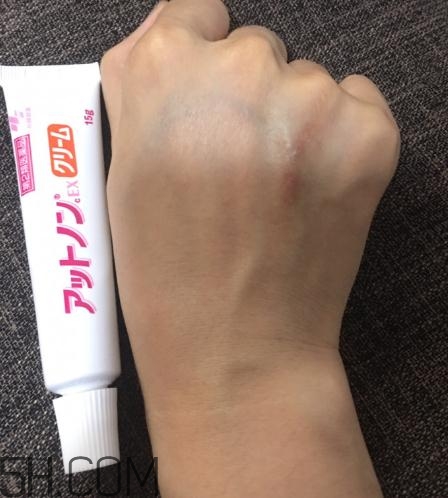 小林制藥祛疤膏有效嗎？小林制藥祛疤膏怎么樣？