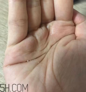 雪肌精卸妝油糊眼睛嗎？雪肌精卸妝油悶痘嗎？