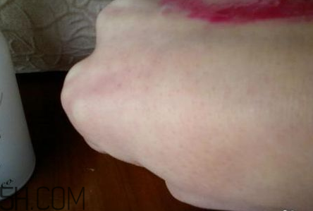 芭妮蘭卸妝膏用了長閉口怎么辦？芭妮蘭卸妝膏孕婦可以用嗎？