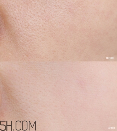 蘭蔻小黑瓶小嫩膜和前男友面膜哪個好？