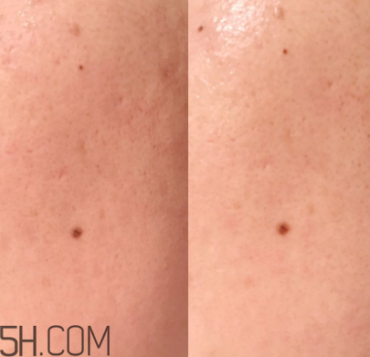 蘭蔻美膚修護美容液可以代替乳液嗎？什么功效？