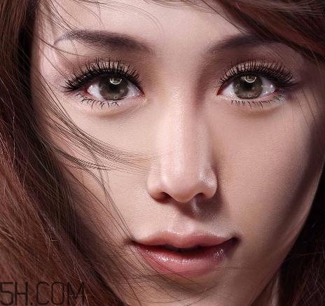 上瞼提肌手術(shù)有必要嗎？上瞼提肌后是永久的嗎？