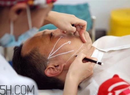 大v線提升有副作用嗎？大v線和小v線的區(qū)別