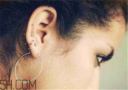 打耳洞后該如何預(yù)防感染？打耳洞前需要注意的細(xì)節(jié)？
