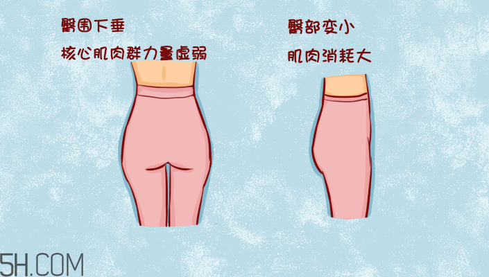 臀部護(hù)理對(duì)健康有什么影響？日常如何保養(yǎng)臀部健康？