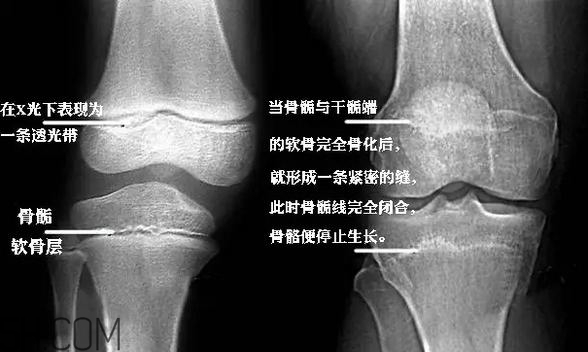 孩子學(xué)街舞好不好？學(xué)街舞好處多多