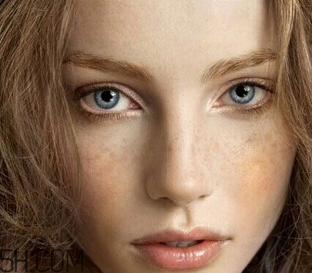 中年女性長斑怎么辦？深究長斑原因