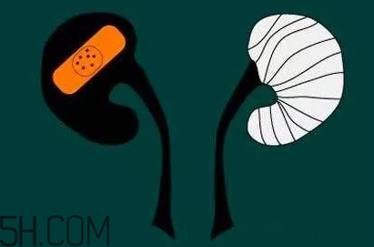 為什么容易得腎炎？慢性腎炎腎衰很難發(fā)現(xiàn)