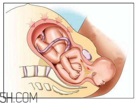 分娩如斷骨？分娩痛感沒那么夸張