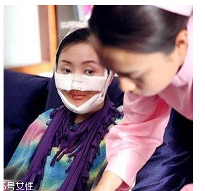 幻丑癥有多可怕？極端時會自戕