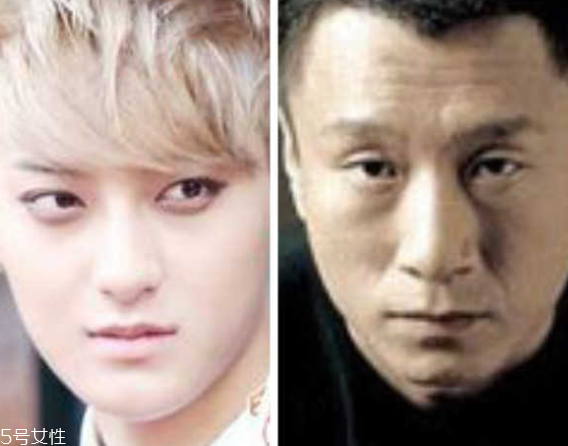 死魚眼怎么治？割雙眼皮可以治死魚眼