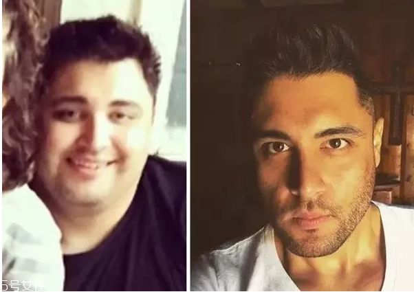 減肥對(duì)外貌的改變有多大？運(yùn)動(dòng)減肥的相關(guān)問題