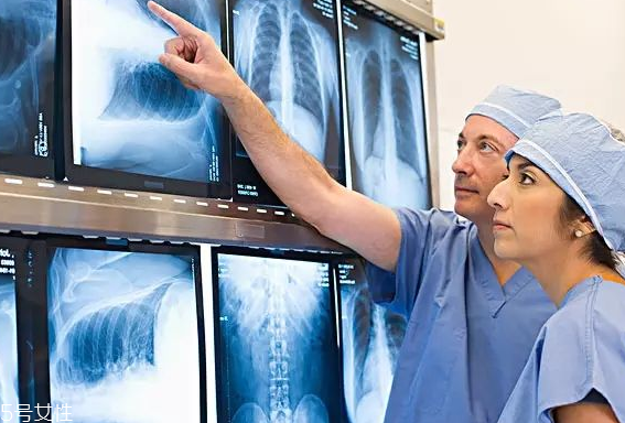 癌癥篩查有哪些真相？查與不查一個樣