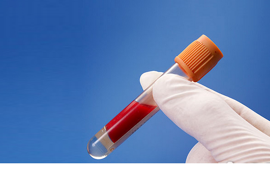 血里的垃圾有哪些？油脂過多成為垃圾油