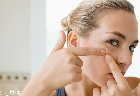 長痘的根源是什么？原來是吃糖過多