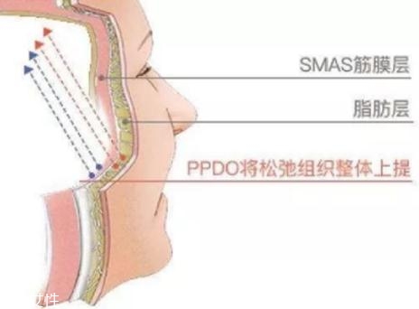 大v線會斷嗎？一定要選擇正規(guī)整形醫(yī)院