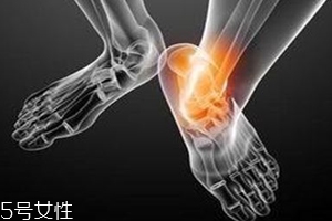 痛風(fēng)跟飲食有關(guān)？痛風(fēng)更多與遺傳有關(guān)