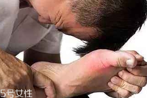 痛風(fēng)可以治愈嗎？無法治愈但能控制