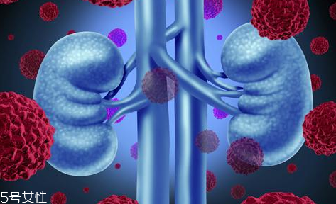 腎病為什么會發(fā)展到尿毒癥？這些因素一定要注意