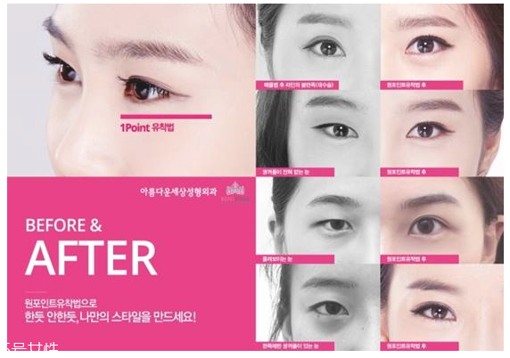 韓國人最愛整哪兒？韓國整形部位TOP4