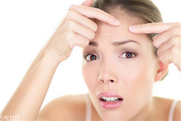 額頭毛孔粗大用什么護(hù)膚品？額頭毛孔粗大和出油有關(guān)系