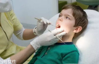 牙結(jié)石能自動脫落嗎？除了洗牙別無他法